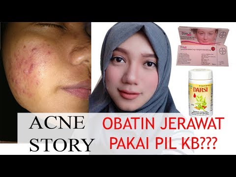 download lagu mp3 mp4 Cara Menghilangkan Jerawat Efek Kb, download lagu Cara Menghilangkan Jerawat Efek Kb gratis, unduh video klip Cara Menghilangkan Jerawat Efek Kb