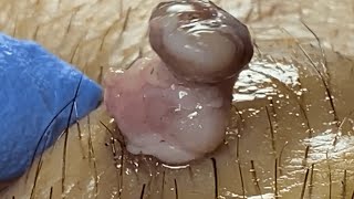 Download lagu 𝑭𝒂𝒄𝒊𝒂𝒍 𝑻𝒓𝒆𝒂𝒕𝒎𝒆𝒏𝒕 𝒇𝒐𝒓 𝑺𝒕𝒓𝒆𝒔𝒔 𝑹𝒆𝒍𝒊𝒆𝒇 𝑫𝒆𝒆𝒑 𝑪𝒍𝒆𝒂𝒏𝒊𝒏𝒈 & 𝑪𝒂𝒍𝒎𝒊𝒏𝒈 𝑴𝒂𝒔𝒔𝒂𝒈𝒆 #84831 mp3