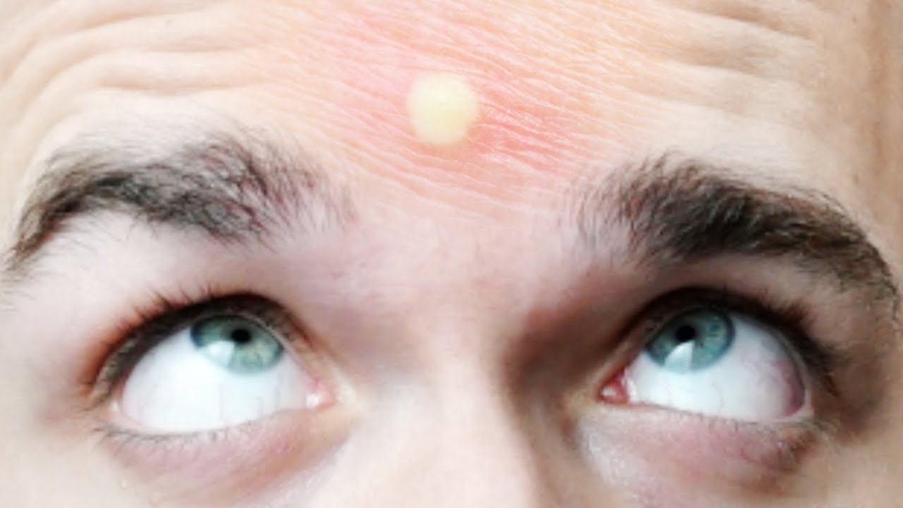 APPUIEREZ-VOUS SUR LE BOUTON ? #2 thumbnail