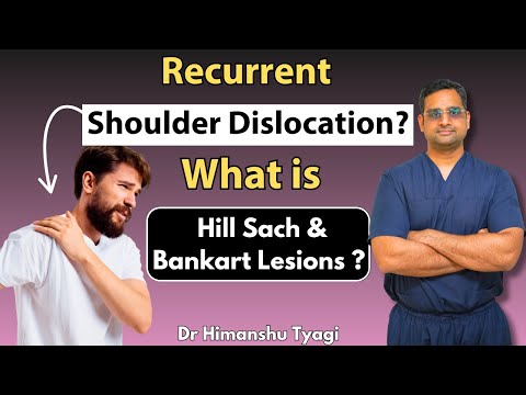 Recurrent shoulder dislocation  What is hill sach & Bankart lesions