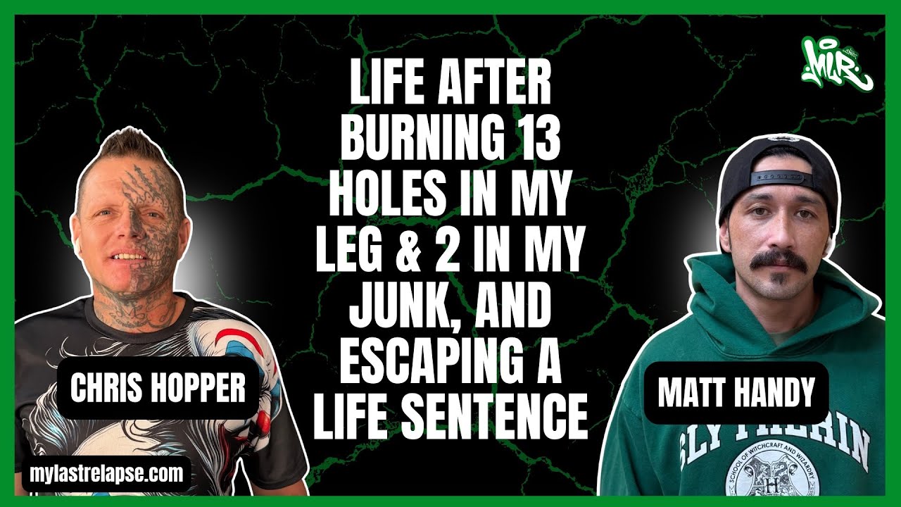 Life After Burning 13 Holes in My Leg & 2 in My Junk, and Escaping a Life Sentence, and Killing Myself in the Hospital
