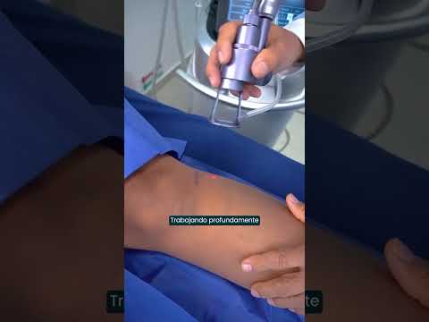 video GDvJ5h2n4ik
