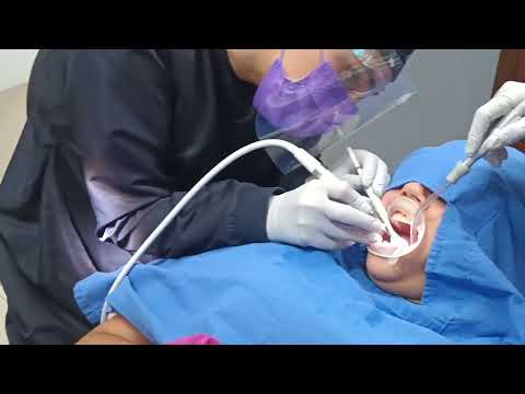 Profesional Teeth Cleaning  with Airflow® technology in Puerto Vallarta - new no pain technology