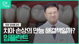 임플란트, <b>치아</b> 손상의 만능 해결책? 미리보기 썸네일