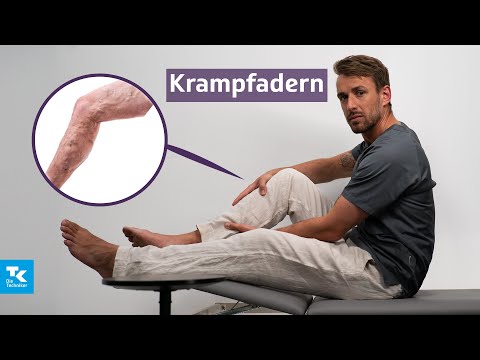 Krampfadern (Varizen) verstehen: Ursachen, Symptome, Diagnose & Therapie | DocTommy