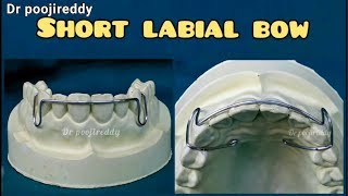 Download lagu Short labial bow fabrication |short labial bow dentistry orthodontics |Dr poojireddy mp3 Download lagu Short labial bow fabrication |short labial bow dentistry orthodontics |Dr poojireddy mp3