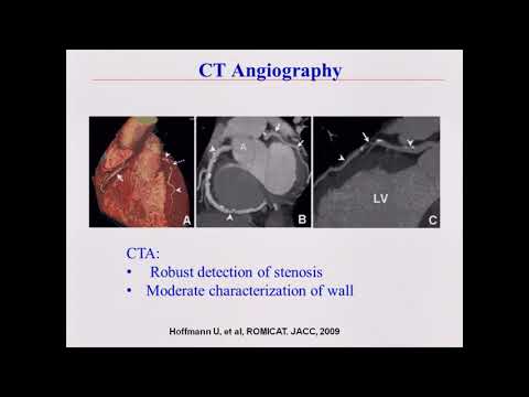 Molecular Imaging of Myocardial Ischemia and Remodeling