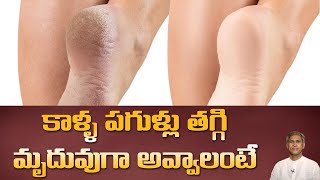 Treat your Dry Cracked Heels at Home | Get Soft and Beautiful Feet | Dr. Manthena