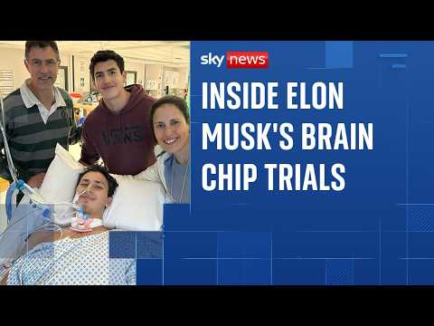 What it's like to trial Elon Musk's brain chip