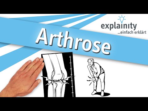 Arthrose einfach erklärt (explainity® Erklärvideo)