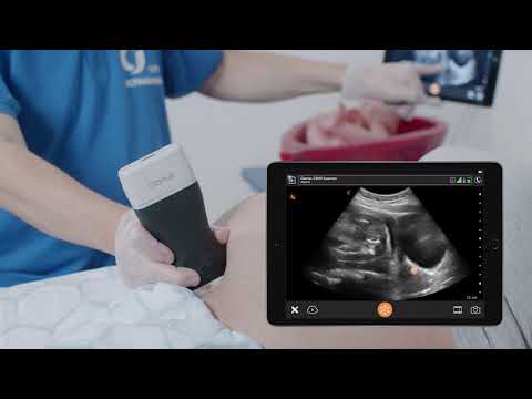 Position of the Fetus