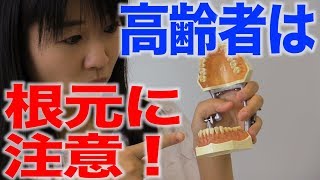 高齢者のむし歯の特徴