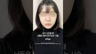 고민할 시간도 아까운 울쎄라 전후💘