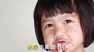 預防水痘