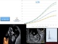 DR ANTONIO LIMAY BIOMETRIA FETAL JUNIO 2013