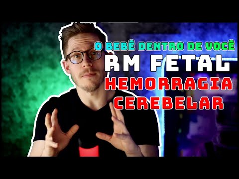 👶 O bebê dentro de você | RM FETAL - hemorragia cerebelar