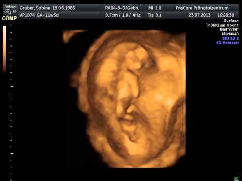 Ultraschall 23.07.2013