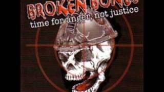 Broken Bones - 