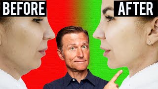 Download Lagu Fastest Way to Rid Your DOUBLE CHIN (Turkey Neck) Thumbnail
