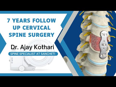 Patient Testimonials | Dr. Ajay Kothari - Spine Surgeon | Shivaji Nagar, Pune