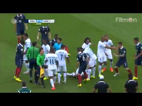 France vs Honduras 2014 World Cup:  Pelea/Fight