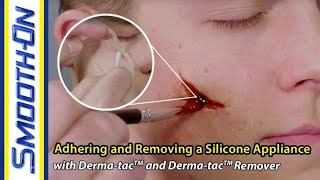 Derma-tac Video: