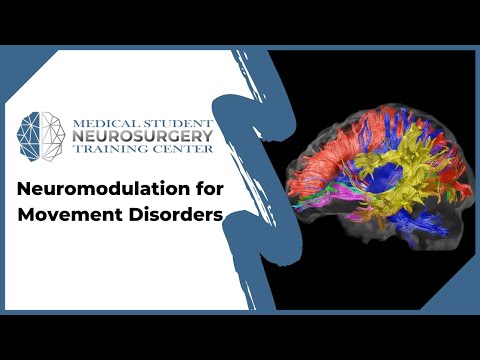 Neuromodulation for Movement Disorders
