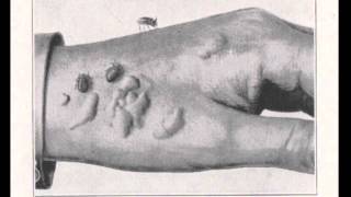 Pests in the City: Flies, Bedbugs, Cockroaches, and Rats