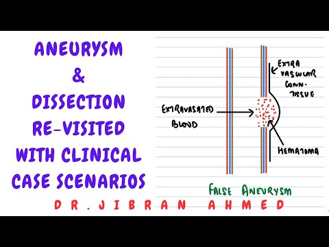 MYOCARDIAL INFARCTION II HEART II SYSTEMIC PATH II ROBBINS 10TH E II PATHOLOGY LECTURE