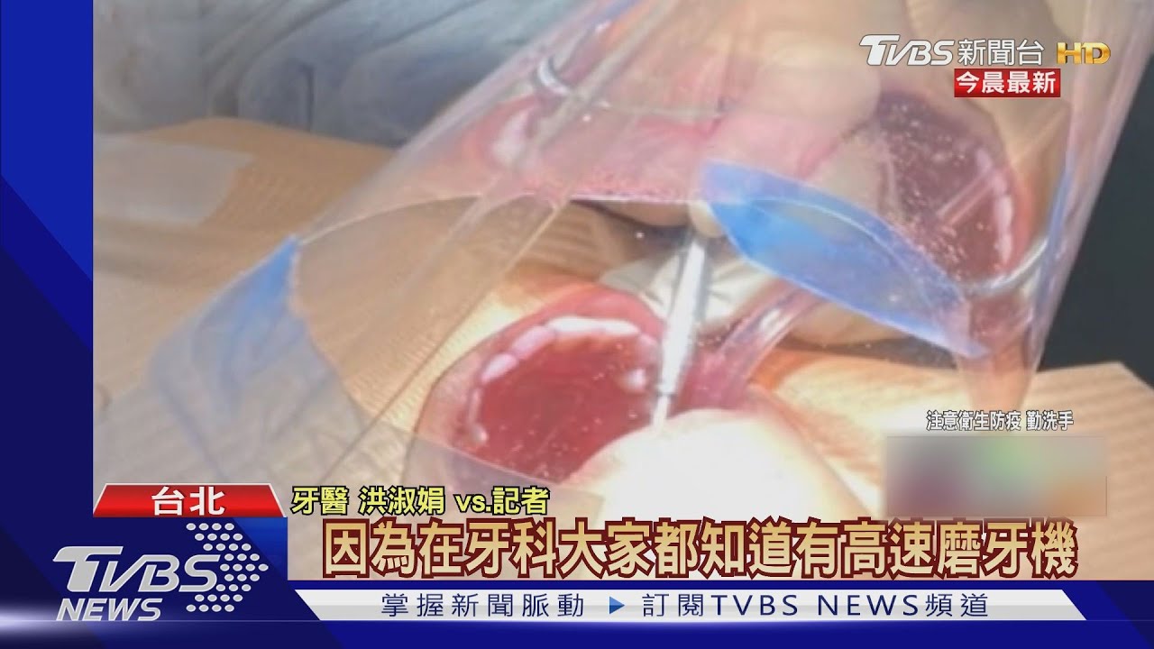 隔絕看牙飛沫噴濺! 知名牙醫研發「飛沫隔離罩」