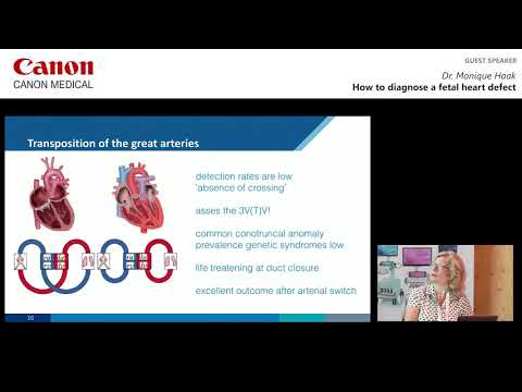 ISUOG 2018 Dr  Monique Haak   How to Diagnose a Fetal Heart Defect