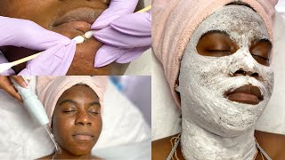 Download lagu Deep Cleansing Oxygen Facial Close Up Extractions... mp3