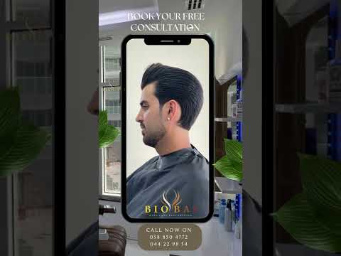 Dubai hair replacement for men