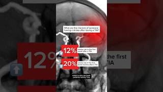 What is a TIA (Transient Ischemic Stroke)