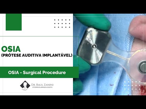 Miniatura: OSIA - Surgical Procedure