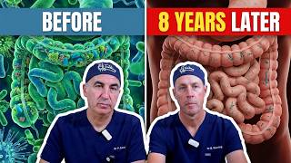 Can One Course Of Antibiotics Change Your Gut for 8 Years? Here's What Doctors Found