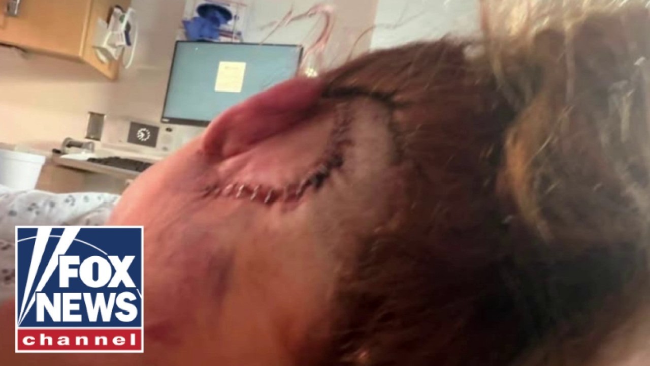 DoorDasher suffers skull fractures, brain bleeds after BRUTAL assault