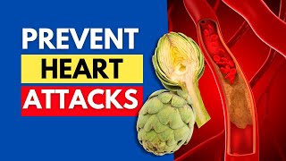 5 Powerful Vegetables to Clean Arteries and Prevent Heart Attacks