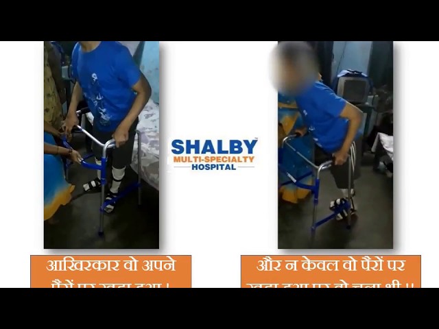 Cerebral Palsy Treatment Video 1