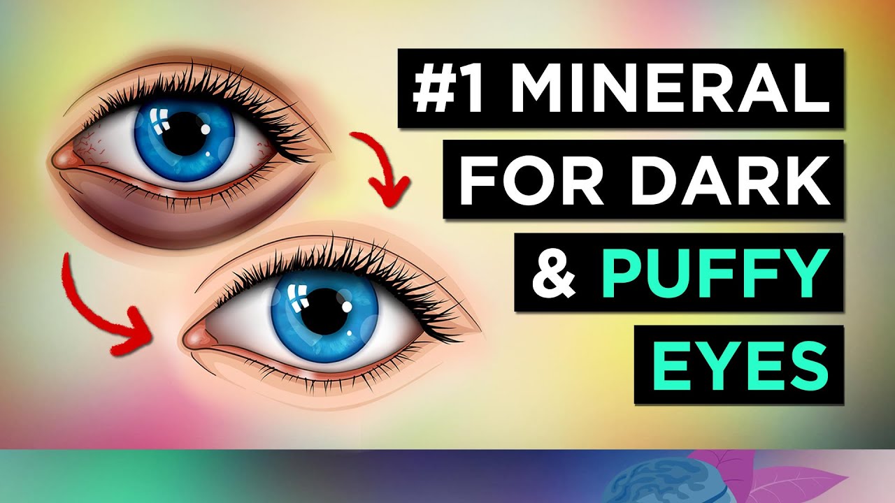 #1 Secret Weapon: Conquer Puffy Eyes & Dark Circles