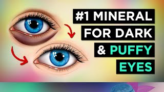 #1 Mineral To CURE Puffy Eyes