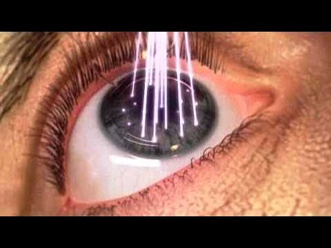 La fotografia del ragazzo in lentiggini La crema per le mani per togliere posti di pigmentary