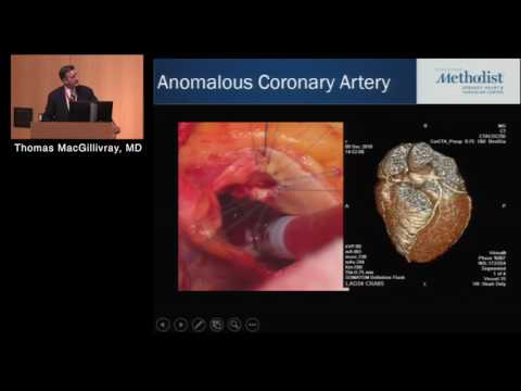 Advances in Surgical Treatment of CHD (Thomas MacGillivray, MD)