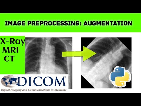 Image Preprocessing How To Do Augmentation Python Programming Itfo