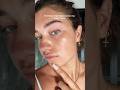 10 Things That Helped Clear My ADULT ACNE Skincare