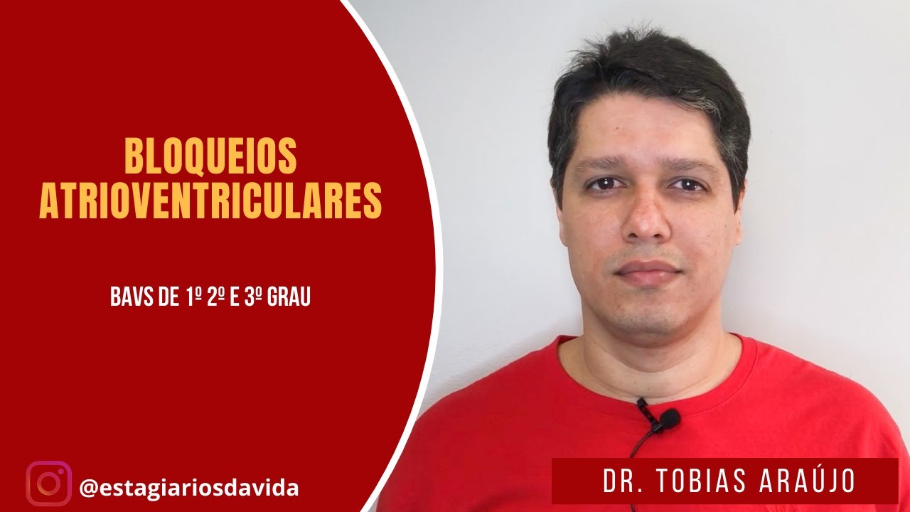 Aprenda de forma fácil Bloqueios Atrioventriculares