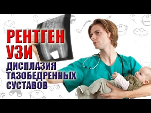 РЕНТГЕН ТАЗОБЕДРЕННЫХ СУСТАВОВ / УЗИ ПРИ ДИСПЛАЗИИ ТАЗОБЕДРЕННЫХ СУСТАВОВ