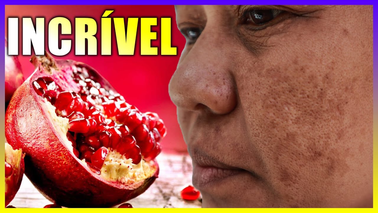 Watch Now Conheça os Benefícios da Romã Clareia Manchas na Pele e Melhora a Saúde Conheça os Benefícios da Romã Clareia Manchas na Pele e Melhora a Saúde