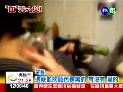 密醫放血治病 小心命被"放"掉!