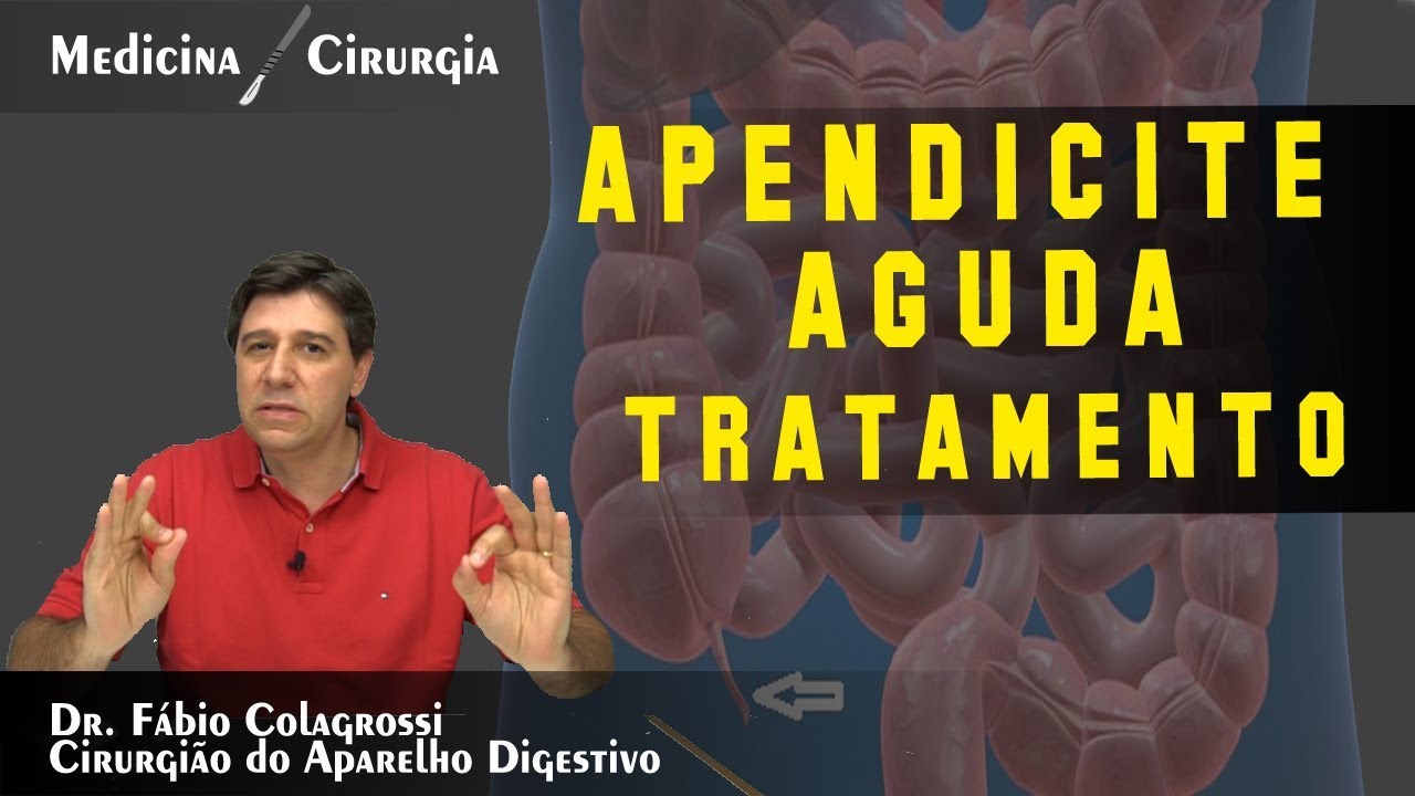 APENDICITE AGUDA - TRATAMENTO